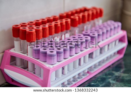 rack with colored tubes in the laboratory workbench / tubes with samples in a rack.