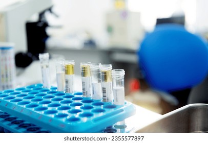 Rack with group of tubes and laboratory microscope