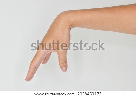 Radial nerve injury or wrist drop of Asian young man. Stock photo © 