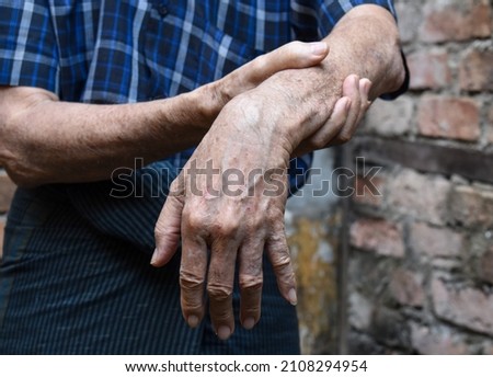 Radial nerve injury or wrist drop of Asian elder man. Stock photo © 