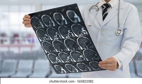 Radiology Doctor Examines Film X-ray Brain By Ct Scan Mri Of The Patient.