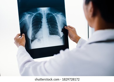 Radiology Doctor Examining Chest X Ray Stock Photo 1829728172 ...