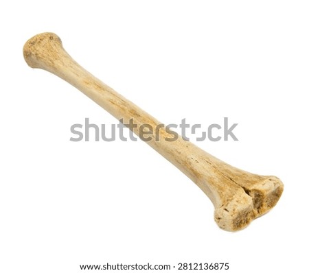 Radius Radius Bone Shown In Side Perspective Wi Isolated On White Background