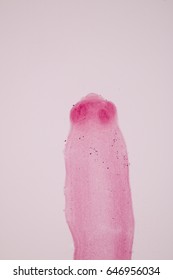 Raillietina echinobothrida is a parasitic tapeworm belonging to the class Cestoda. - Shutterstock ID 646956034