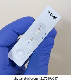 Rapid antibodies test for SIV IgG and IgM test, Simian immunodeficiency virus test, It is a large group of lentiviruses.