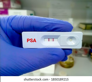Rapid diagnostic test for PSA (Prostate Specific Antigen) with a positive result. Rapid test cassette