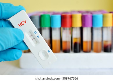 Rapid Test Cassette For Hepatitis C Virus (HCV) Testing, The Result Showed Positive