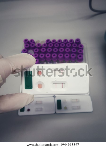 The rapid test Kit for detection of Feline\
Leukemia virus antigen and Feline Immunodeficiency virus antibody\
in feline serum.