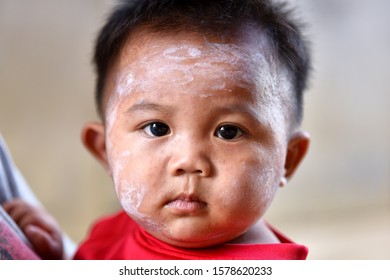 Rash Baby Allergy On Face / Disease Baby Boy Face Dry Skin Itching And Lesion Caused From Allergy In Newborn Asia. Concept Of Health Care For Children. Selective Focus