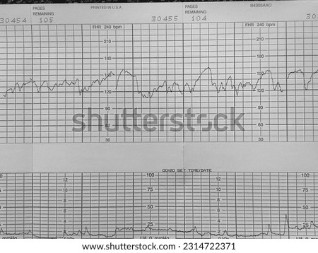 Reactive fetal heart monitor strip