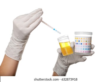 Reagent Strip Test Urinalysis Stock Photo 632873918 | Shutterstock