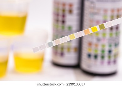 reagent strips used in urinalysis to analyze Leukocytes, Urobilinogen, Bilirubin, Blood, Nitrite, pH, Density, Protein, Glucose and Ketosis bodies.