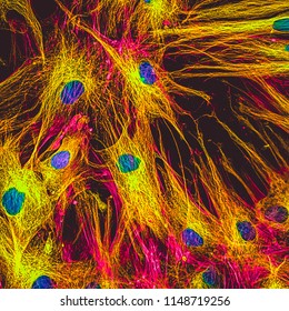 Real fluorescence microscopic view of human skin cells in culture. Nucleus are in blue, actin filaments are in pink, tubulin was labeled with yellow