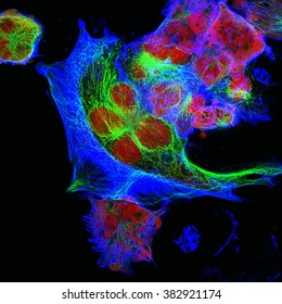 Real Fluorescence Microscopic View Of Human Neuroblastoma Cells 