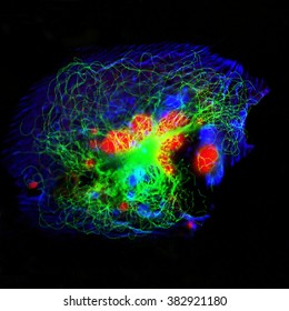 Real Fluorescence Microscopic View Of Human Neuroblastoma Cells 