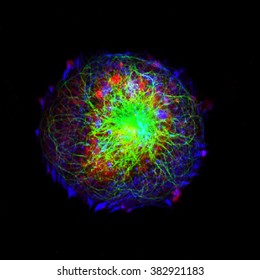 Real Fluorescence Microscopic View Of Human Neuroblastoma Cells 