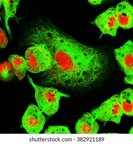 Real Fluorescence Microscopic View Of Human Neuroblastoma Cells 