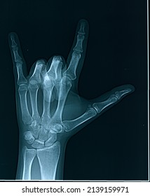 Real Hand Xray Devil Horns Love Stock Photo 2139159971 | Shutterstock