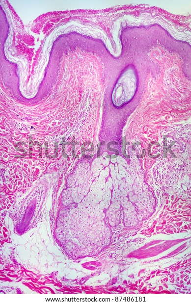 Real Human Sebaceous Sweat Gland Photomicrograph Stock Photo (Edit Now ...