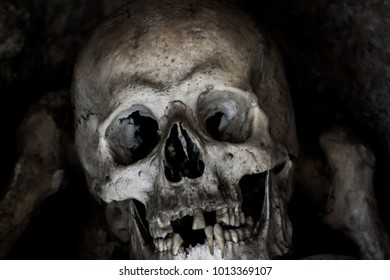 Real Human Skull