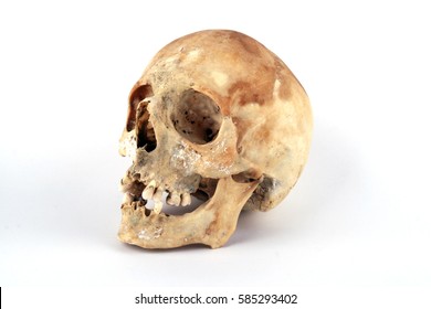 Real Human Skull