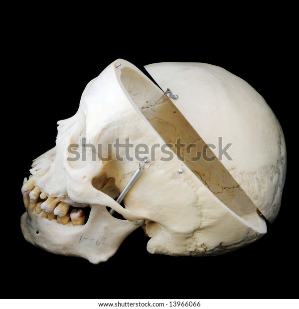 Real Human Skull Cap Cut Away Stock Photo Edit Now 13966066