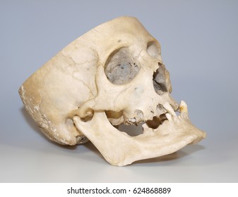 Real Human Skull Used Like Teaching Material