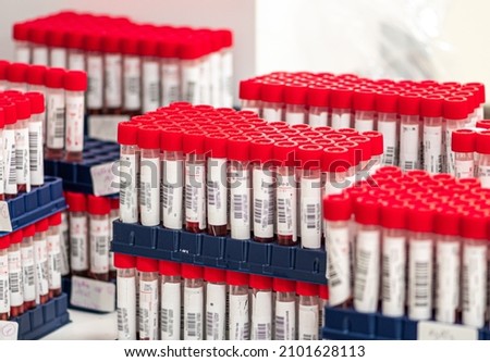 Real molecular PCR test tubes in a row, nasal and oropharyngeal swabs with red reagent in vials, testing for virus or infection disease