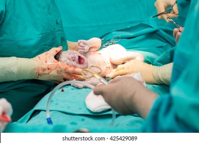 手術室で新生児の帝王切開手術 の写真素材 今すぐ編集