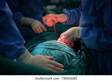 Real Operation Of Cesarean Section For New Born Baby In Operating Lab Room. Doctor Using Medical Tool To Absorb Blood From Infant Mouth Before Pulling Baby Out For Mother Belly.