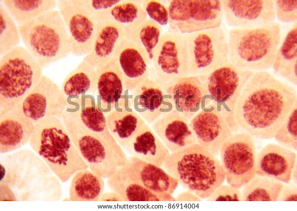 Real photo of many damaged\
cells (destruction of interphase chromatin and pathology of\
nucleoli)