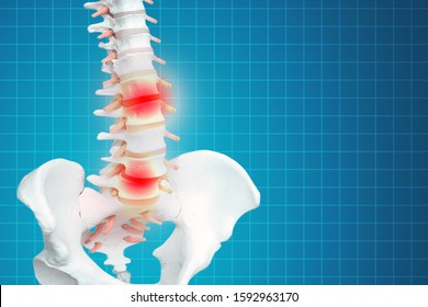 Realistic skeletal human spine and vertebral column or intervertebral discs on a dark background. Lower back pain. Vertebral column in glowing highlight as a medical health care concept.