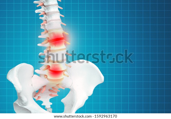 Realistic\
skeletal human spine and vertebral column or intervertebral discs\
on a dark background. Lower back pain. Vertebral column in glowing\
highlight as a medical health care\
concept.