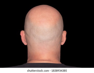 Rear view of a bald head. Adult with alopecia or hair loss. Adult man head view isolated on black background