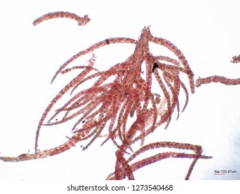 Red Algae Under Microscopic View