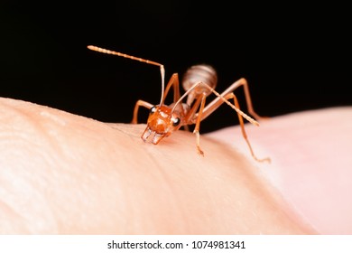 Red Antred Ant Bite Skin Background Stock Photo Shutterstock