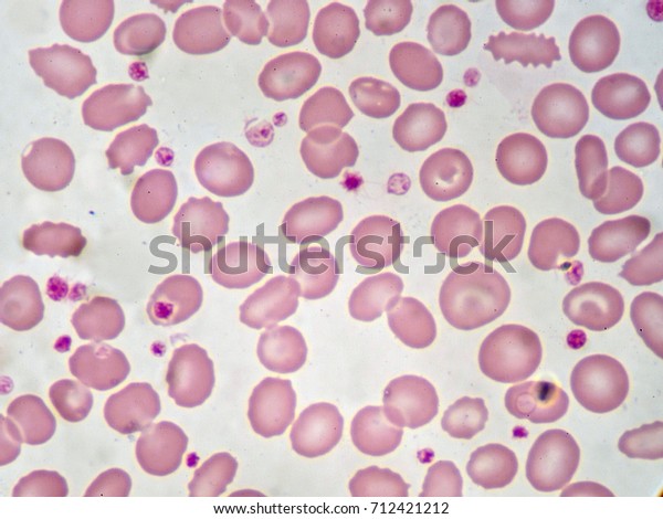 Red Blood Cell Platelet Peripheral Blood Stock Photo (Edit Now) 712421212