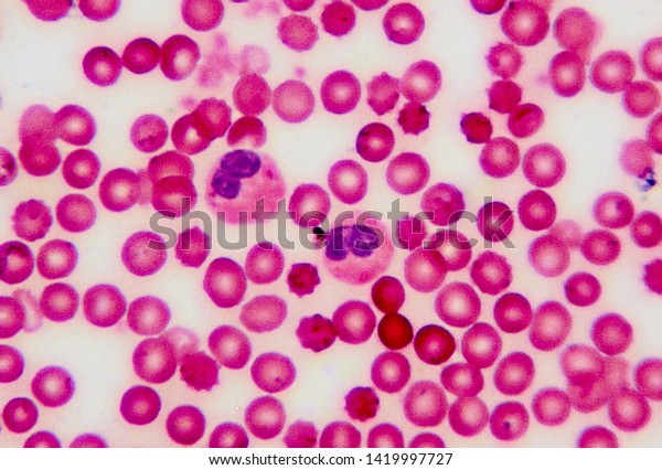 Red Blood Cell Blood Smear On Stock Photo 1419997727 | Shutterstock