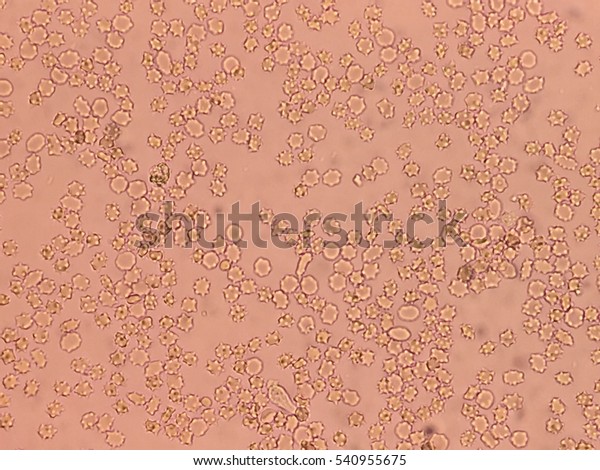 red-blood-cell-urine-stok-foto-raf-540955675-shutterstock