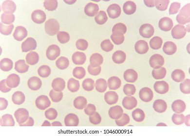 Red Blood Cells Platelet Blood Smear Stock Photo 1046000914 | Shutterstock