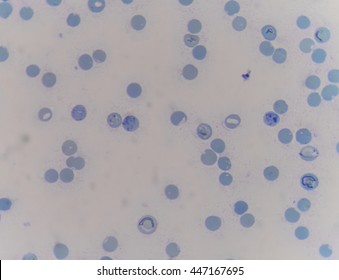 Red Blood Cells Reticulocyte Stain Medical Stock Photo 447167695 ...