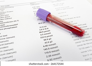 Red blood in test tube on white blank with results in colums.
