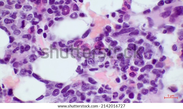 Red\
bone marrow - formation of the various types of blood cells. It is\
comprised of hematopoietic cells in various stages of development, \
reticular connective tissue, sinusoidal\
capillaries.