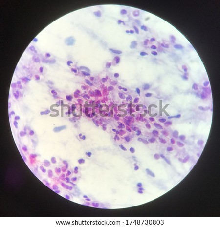 Red branching mycobacterium tuberculosis on blue background in modified acid fast bacilli stain.finding with microscope laboratory background.