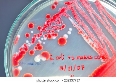 red colony in petridish 