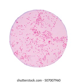 Red Gram Negative Bacilli On White Background.