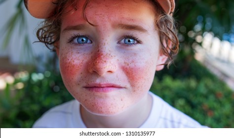 red painful skin, sunburn on the boy's face, sunburn protection need, close-up face of a cute caucasian boy with a sunscreen on his nose, which burned in the sun, freckles face.