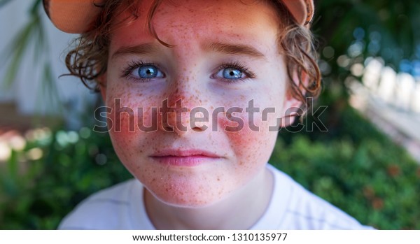赤い痛みを伴う肌 男の子の顔に日焼け 日焼け防止の必要性 鼻に日焼け止めを付けたかわいい白人の男の子の接写面 日焼けしたそばかすの顔 の写真素材 今すぐ編集