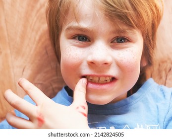 Red-haired Freckled Boy Portrait. Child Biting Nails With Teeth