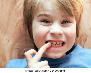 Red-haired Freckled Boy Portrait. Child Biting Nails With Teeth